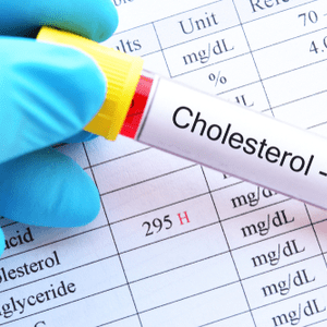 Le bon et le mauvais cholestérol