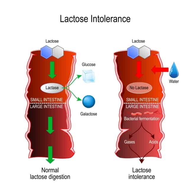 lactose-intolerantie uitgelegd