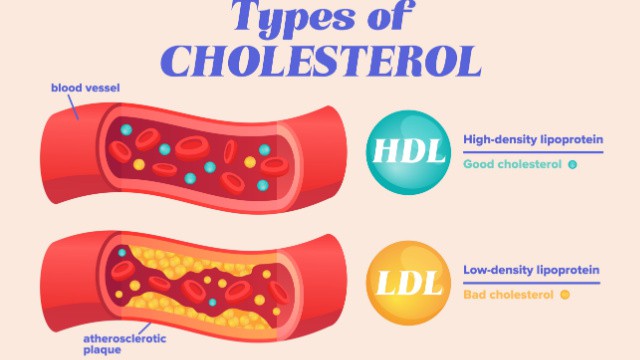 Cholestérol LDL et HDL