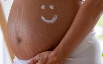 Hoe zwangerschapstriemen voorkomen